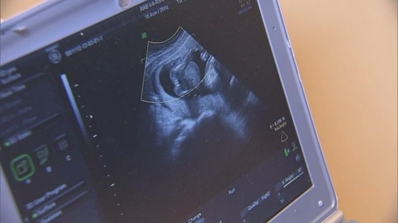 Pro-choice rally held outside Texarkana Federal Courthouse